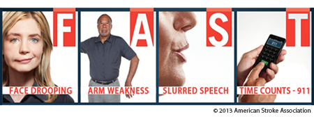 Four panel picture of the F A S T Stroke response